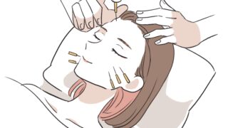 美容鍼で美肌効果